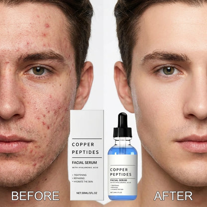 Copper Peptides with Hyaluronic Acid (30ML)